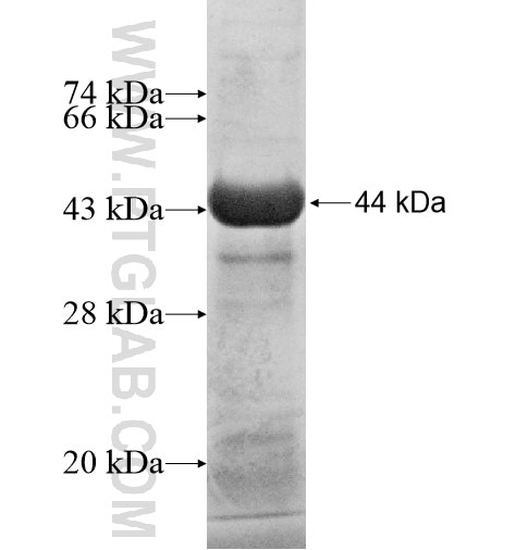 RAI14 fusion protein Ag11869 SDS-PAGE