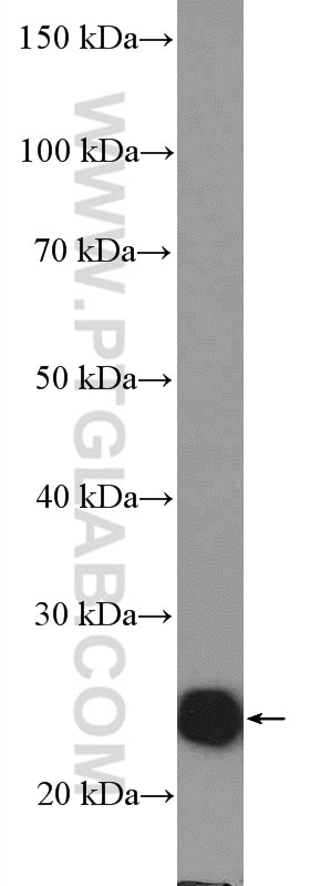 Western Blot (WB) analysis of fetal human brain tissue using RALA Polyclonal antibody (13629-1-AP)