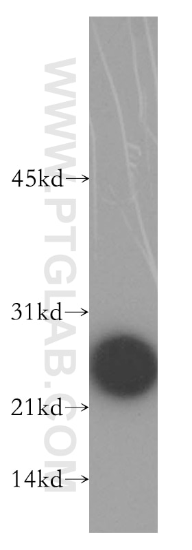 Western Blot (WB) analysis of human brain tissue using RALA Polyclonal antibody (13629-1-AP)