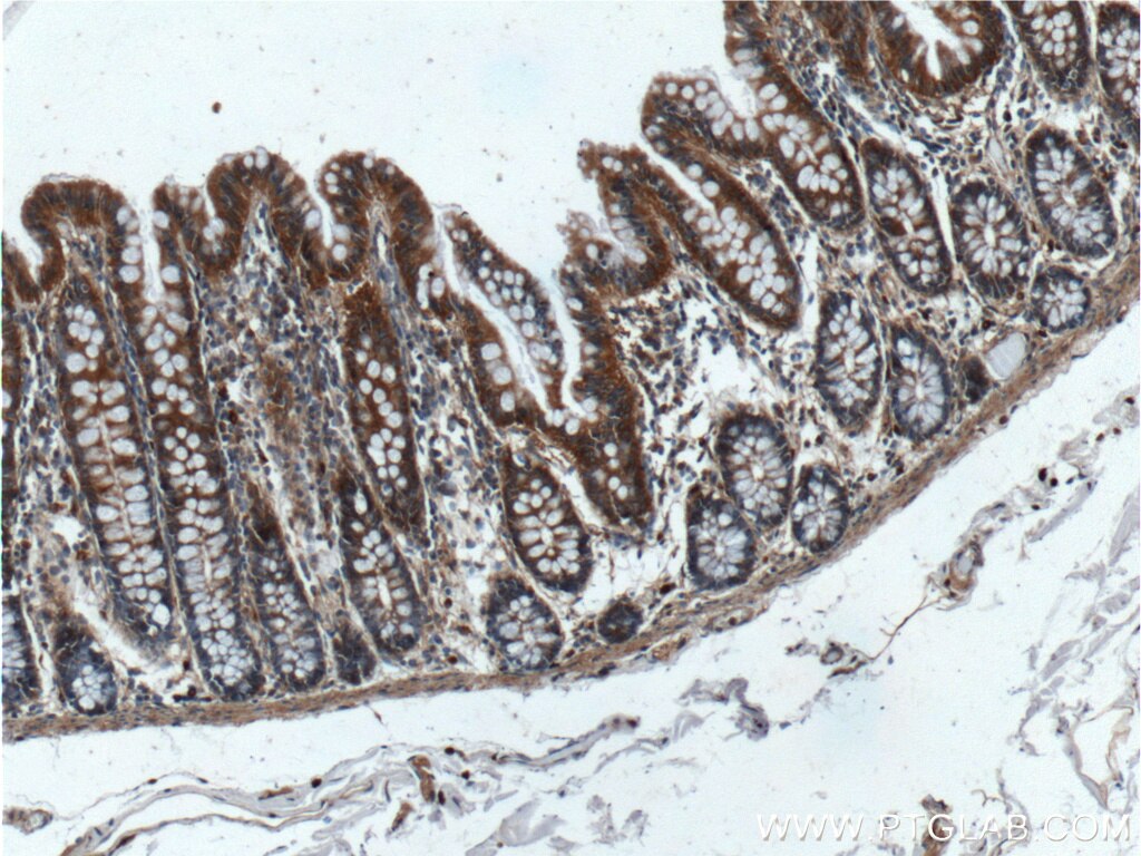 Immunohistochemistry (IHC) staining of human colon tissue using RALB Polyclonal antibody (12340-1-AP)