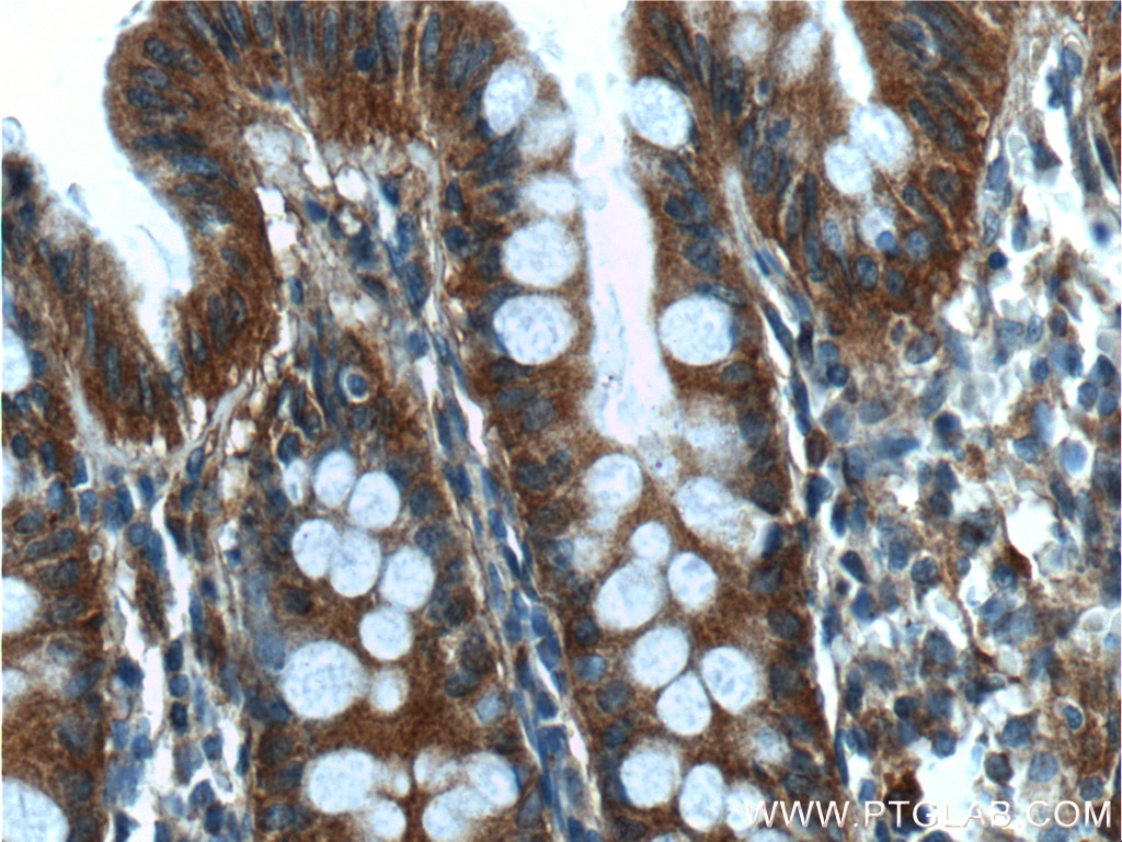 Immunohistochemistry (IHC) staining of human colon tissue using RALB Polyclonal antibody (12340-1-AP)