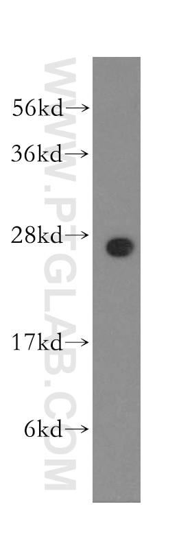 Western Blot (WB) analysis of human brain tissue using RALB Polyclonal antibody (12340-1-AP)