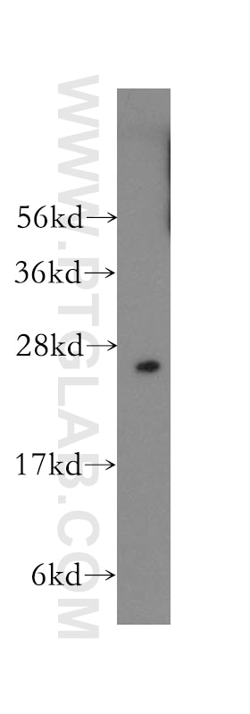 Western Blot (WB) analysis of Y79 cells using RALB Polyclonal antibody (12340-1-AP)