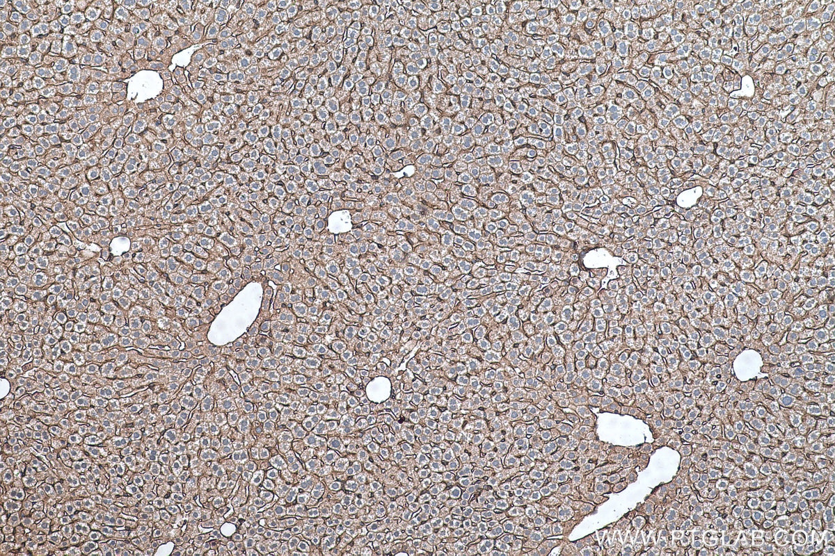 Immunohistochemistry (IHC) staining of mouse liver tissue using RALB Monoclonal antibody (67094-1-Ig)