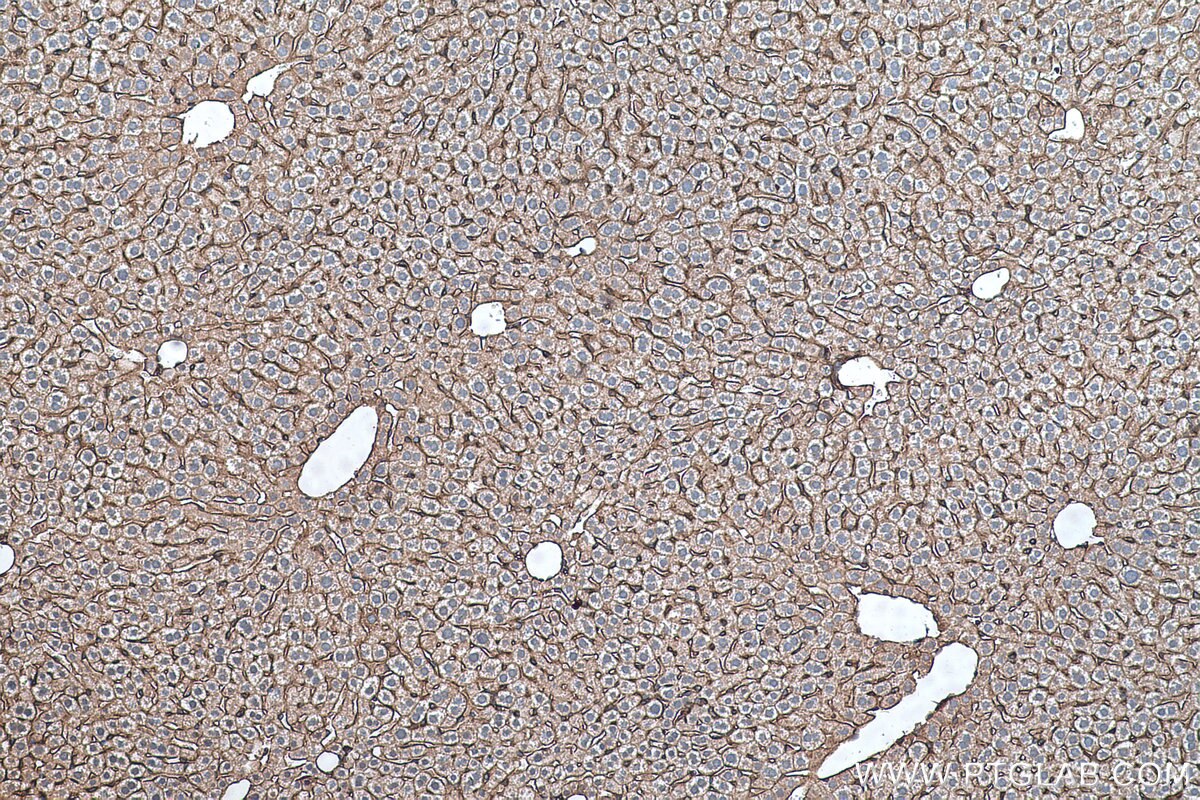 Immunohistochemistry (IHC) staining of mouse liver tissue using RALB Monoclonal antibody (67094-1-Ig)