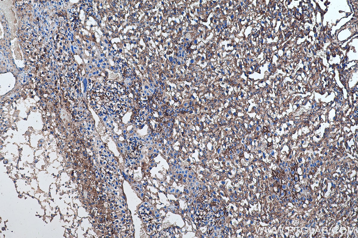 Immunohistochemistry (IHC) staining of mouse placenta tissue using RALB Monoclonal antibody (67094-1-Ig)