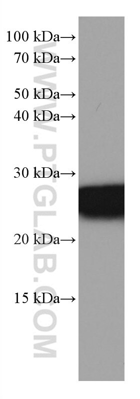 WB analysis of rat brain using 67094-1-Ig