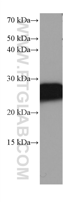 Western Blot (WB) analysis of mouse brain tissue using RALB Monoclonal antibody (67094-1-Ig)