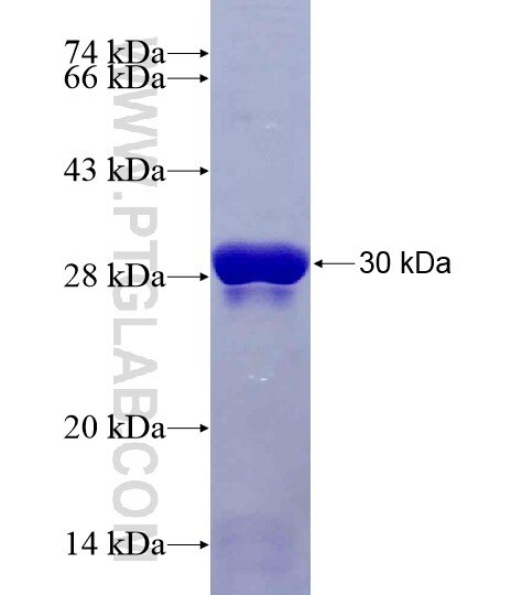 RALB fusion protein Ag28600 SDS-PAGE