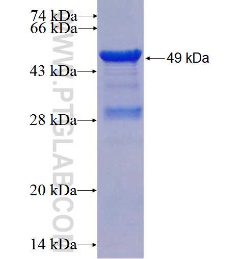 RALB fusion protein Ag2992 SDS-PAGE