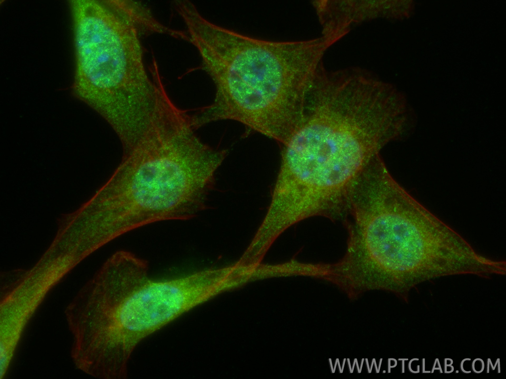IF Staining of NIH/3T3 using 13176-1-AP Immunofluorescence (IF) / fluorescent staining of NIH/3T3 cells using RALBP1 Polyclonal antibody (13176-1-AP)