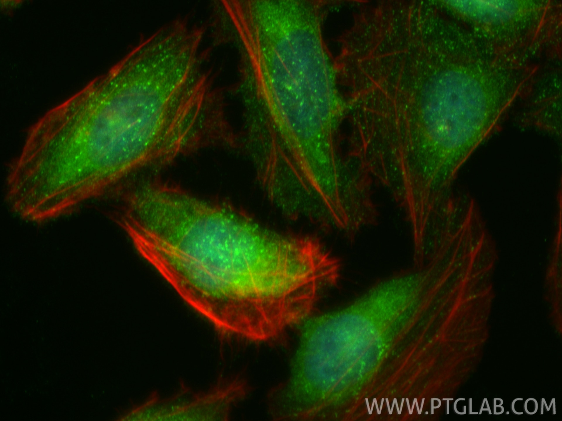 IF Staining of U2OS using 13176-1-AP Immunofluorescence (IF) / fluorescent staining of U2OS cells using RALBP1 Polyclonal antibody (13176-1-AP)