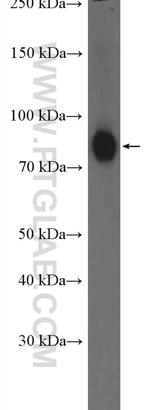 Western Blot (WB) analysis of MCF-7 cells using RALBP1 Polyclonal antibody (13176-1-AP)