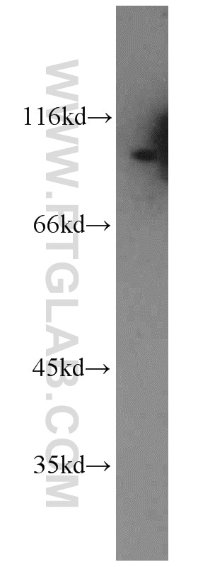 Western Blot (WB) analysis of HepG2 cells using RALBP1 Polyclonal antibody (13176-1-AP)