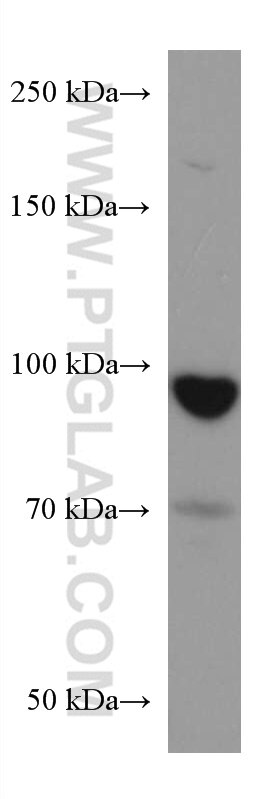 WB analysis of LNCaP using 67359-1-Ig