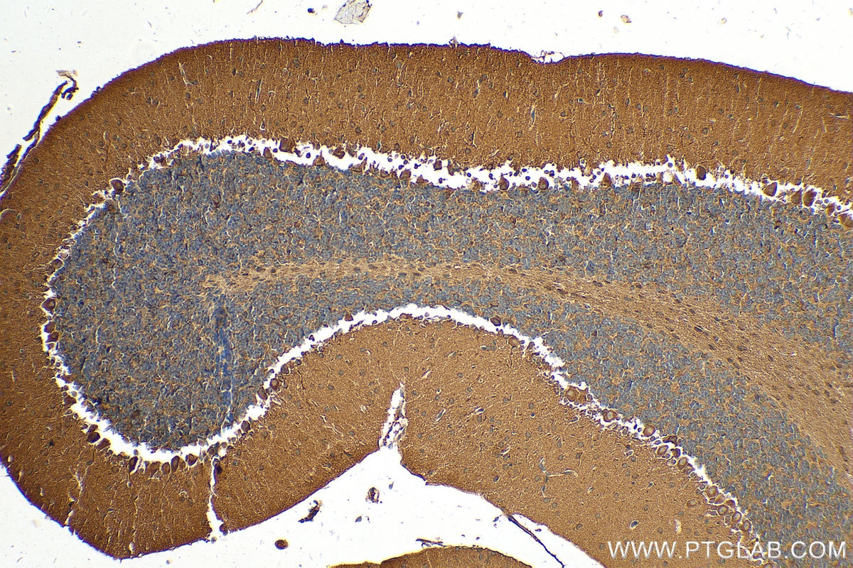 Immunohistochemistry (IHC) staining of mouse cerebellum tissue using RALGAPB Polyclonal antibody (28330-1-AP)