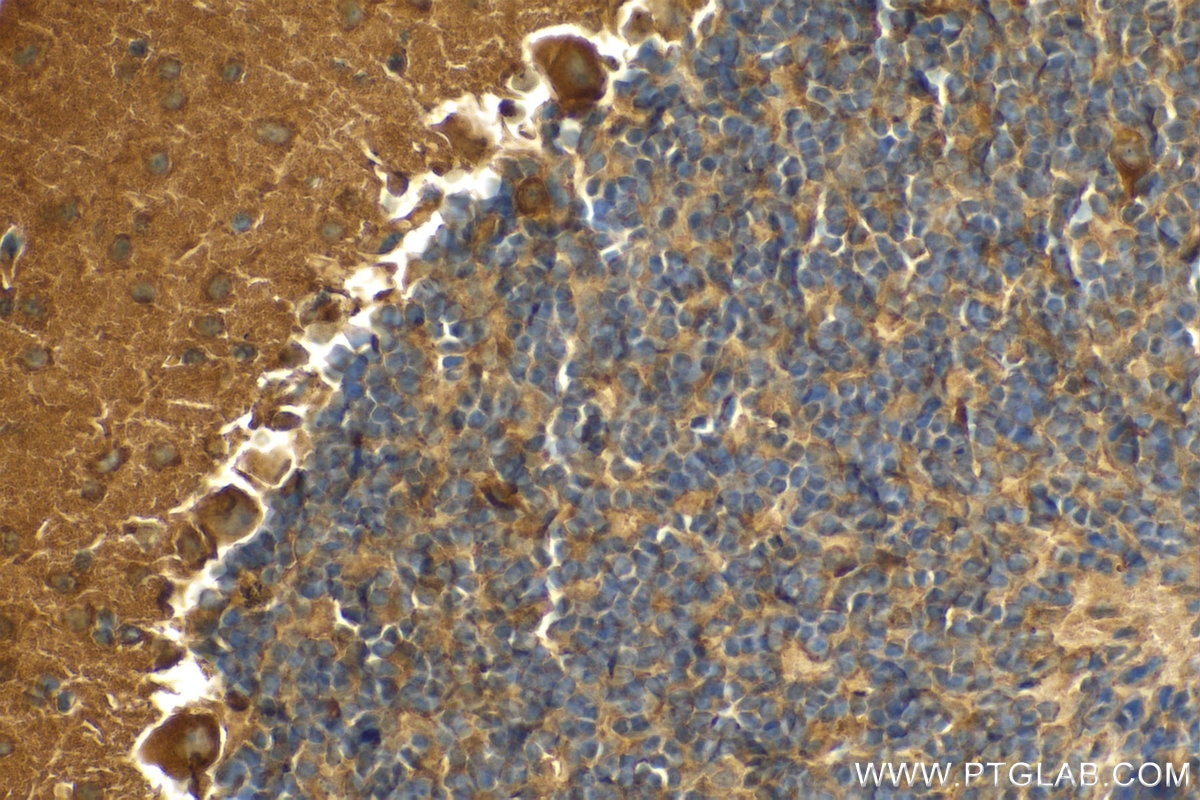 Immunohistochemistry (IHC) staining of mouse cerebellum tissue using RALGAPB Polyclonal antibody (28330-1-AP)