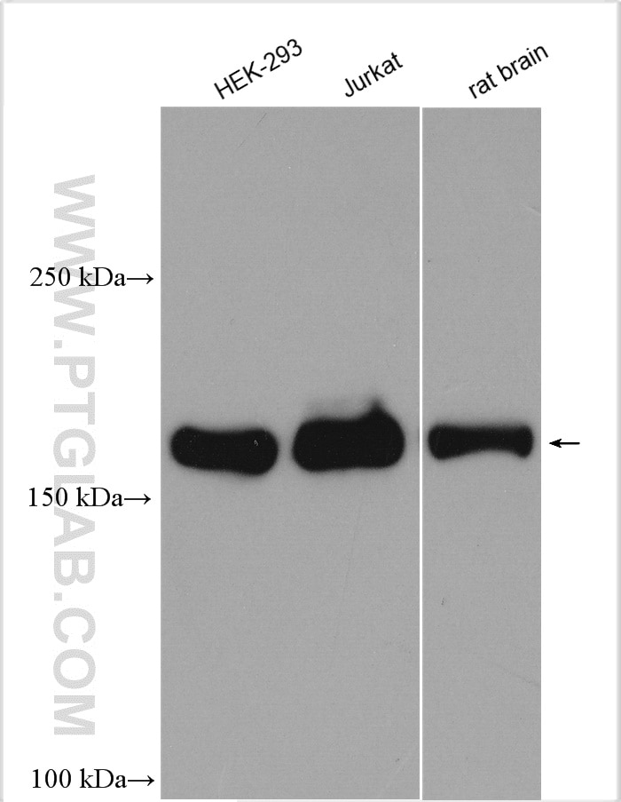 Western Blot (WB) analysis of various lysates using RALGAPB Polyclonal antibody (28330-1-AP)