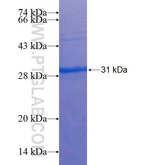 RALGDS fusion protein Ag25526 SDS-PAGE