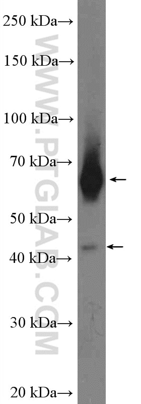 Western Blot (WB) analysis of mouse kidney tissue using RALGPS1 Polyclonal antibody (13368-1-AP)