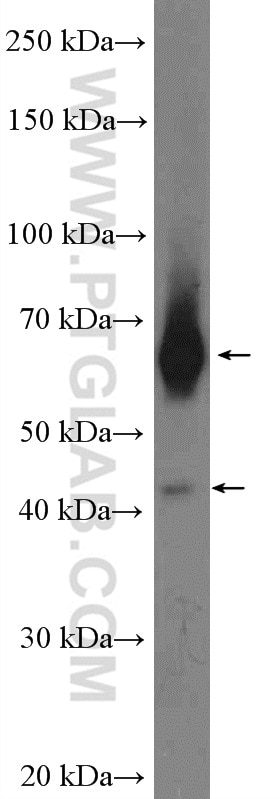 WB analysis of mouse kidney using 13368-1-AP