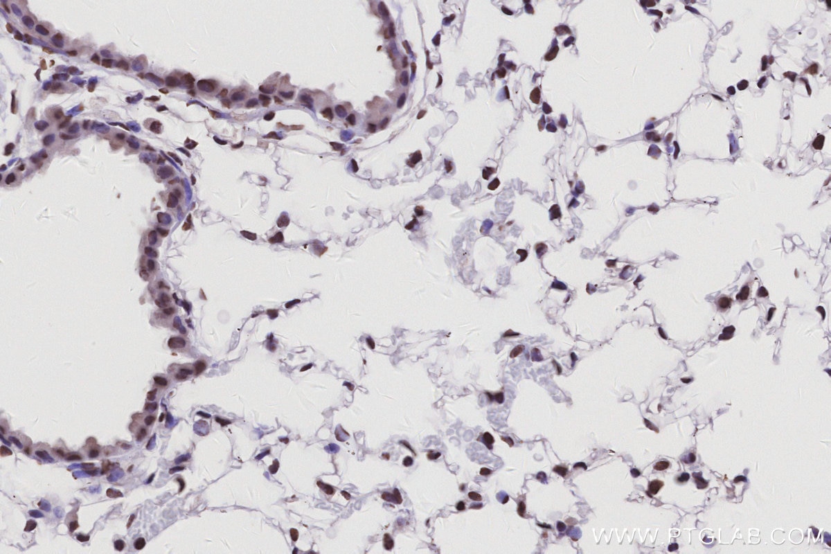 Immunohistochemistry (IHC) staining of mouse lung tissue using RALY Polyclonal antibody (17896-1-AP)