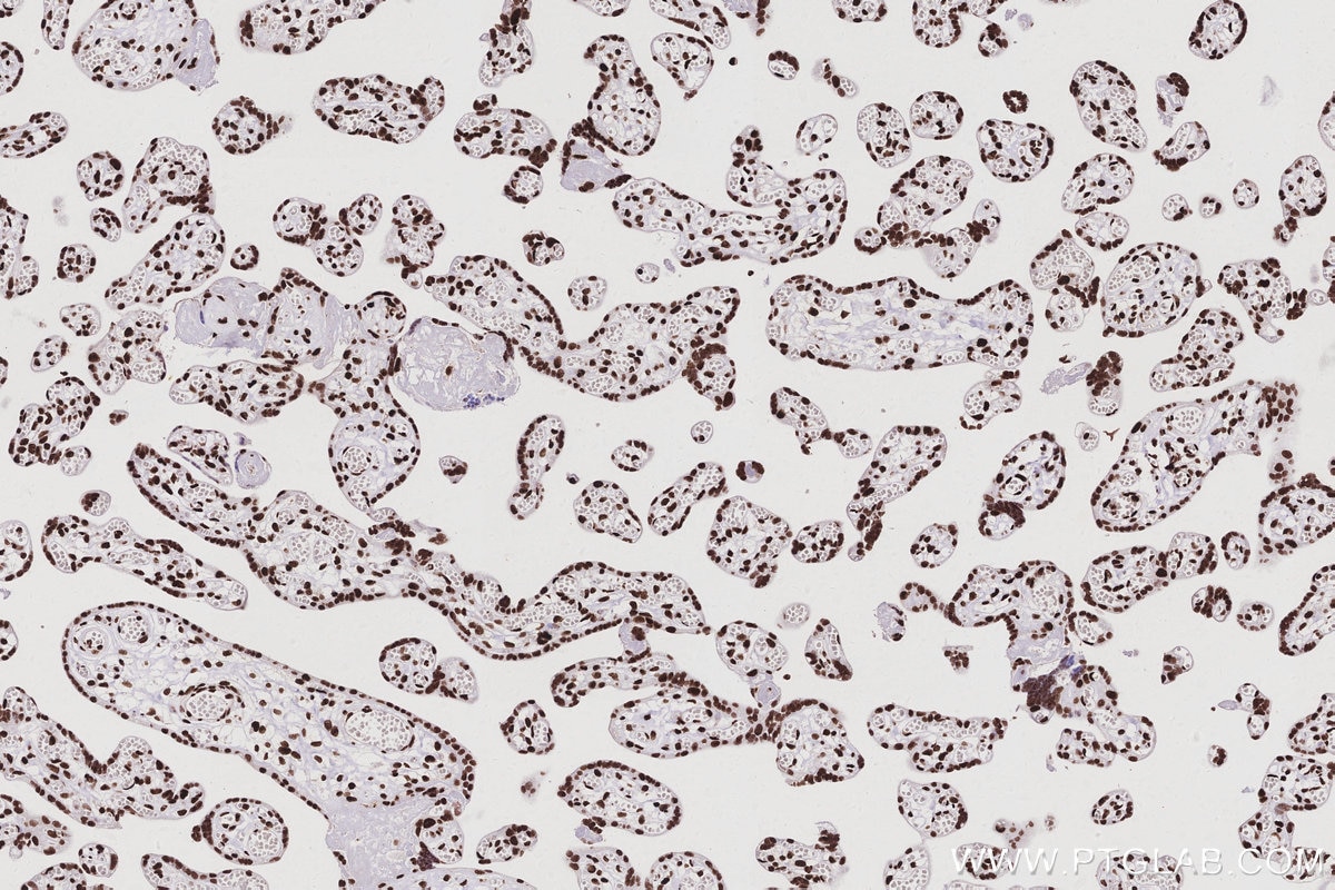 Immunohistochemistry (IHC) staining of human placenta tissue using RALY Polyclonal antibody (17896-1-AP)