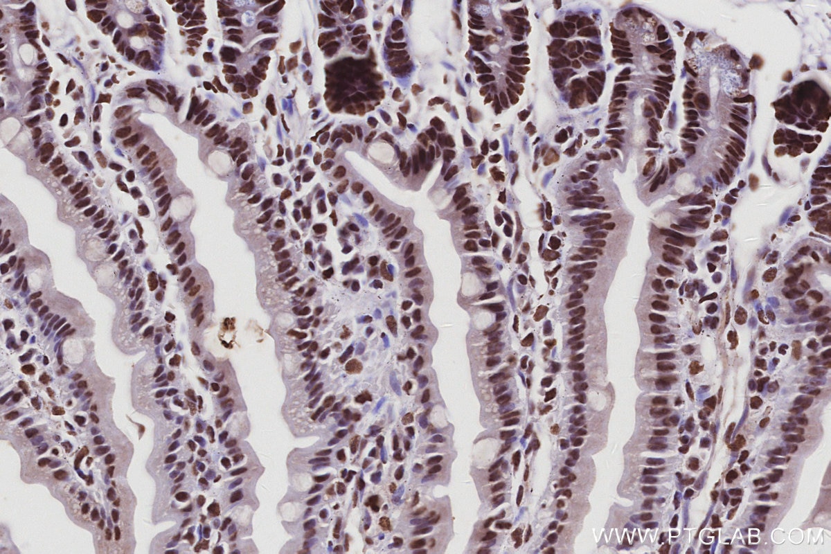 Immunohistochemistry (IHC) staining of mouse small intestine tissue using RALY Polyclonal antibody (17896-1-AP)