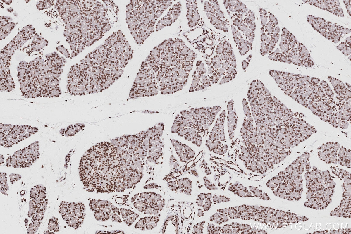 Immunohistochemistry (IHC) staining of rat pancreas tissue using RALY Polyclonal antibody (17896-1-AP)