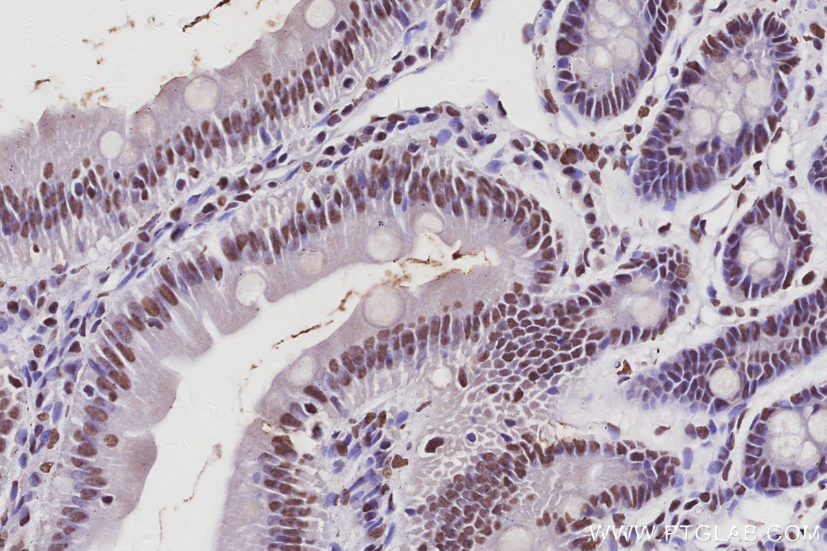 Immunohistochemistry (IHC) staining of rat small intestine tissue using RALY Polyclonal antibody (17896-1-AP)