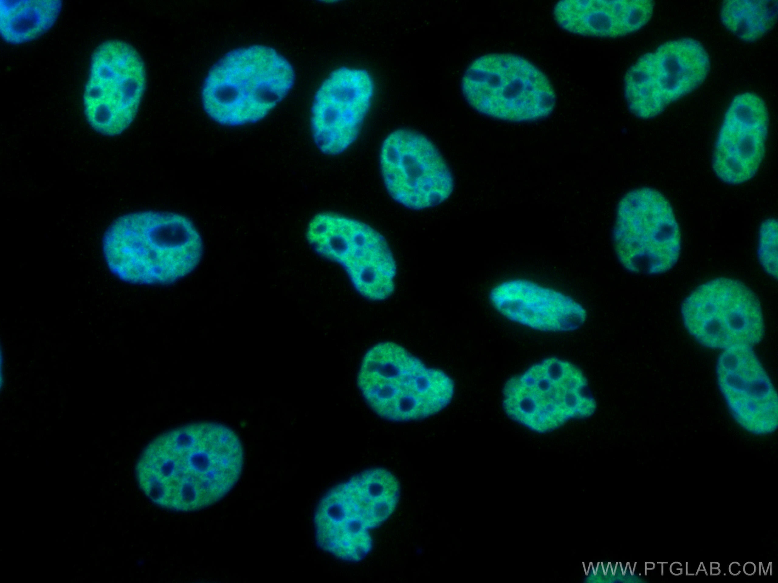 Immunofluorescence (IF) / fluorescent staining of A431 cells using RALY Monoclonal antibody (68011-1-Ig)
