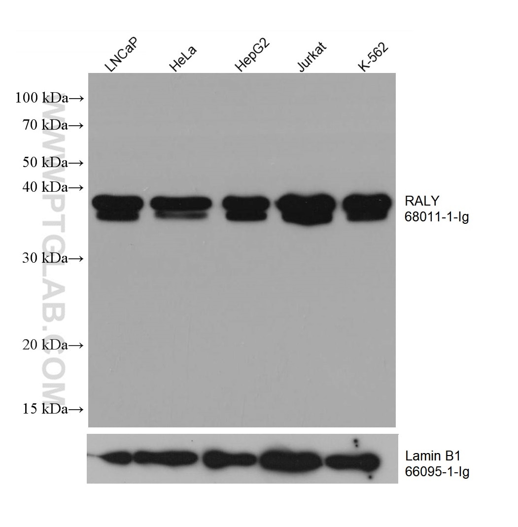 Western Blot (WB) analysis of LNCaP cells using RALY Monoclonal antibody (68011-1-Ig)