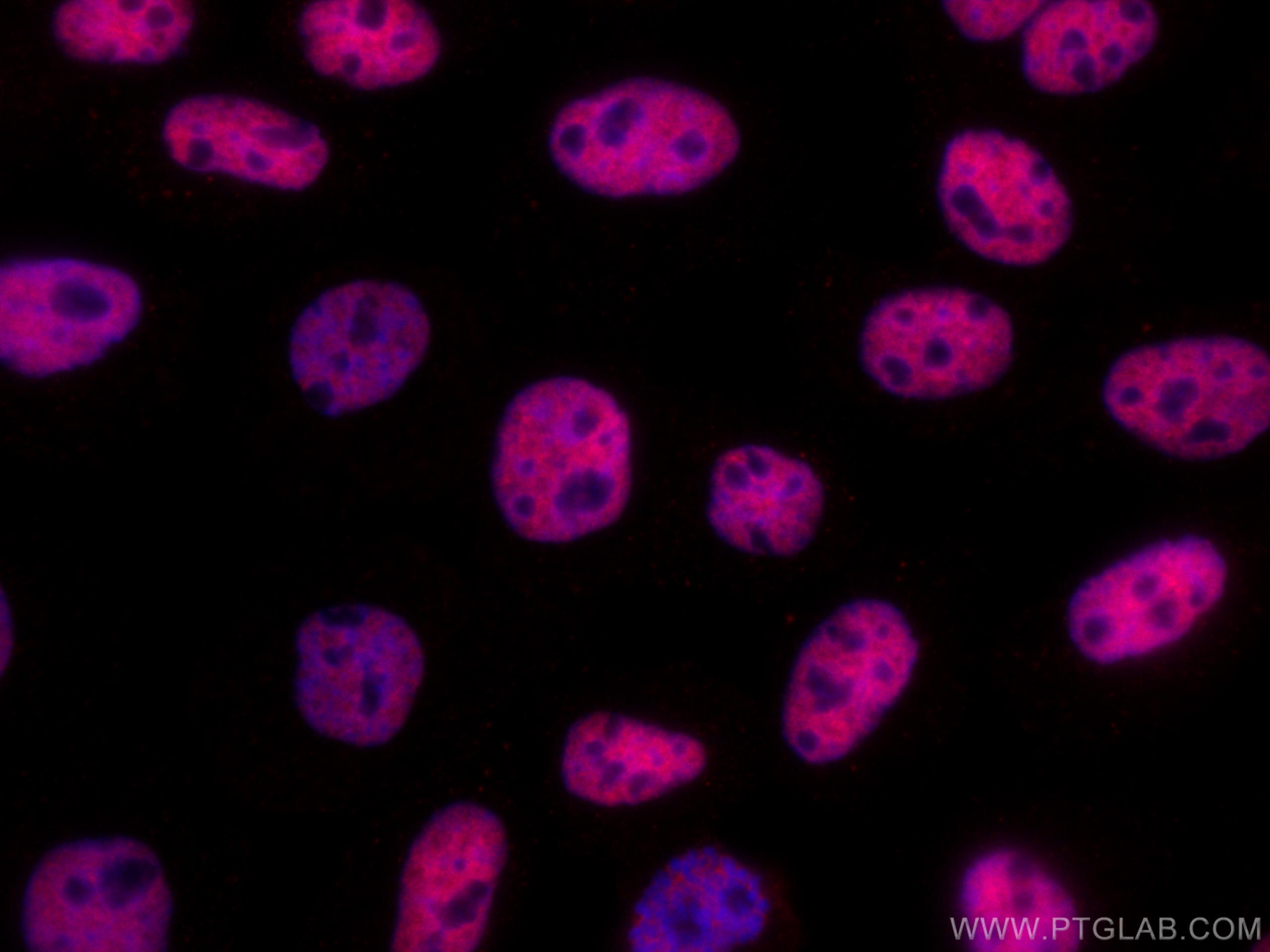 Immunofluorescence (IF) / fluorescent staining of A431 cells using CoraLite®594-conjugated RALY Monoclonal antibody (CL594-68011)