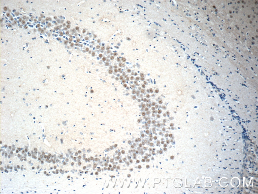 Immunohistochemistry (IHC) staining of mouse brain tissue using RALYL Polyclonal antibody (17179-1-AP)