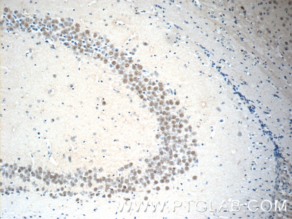 IHC staining of mouse brain using 17179-1-AP