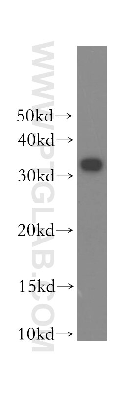 Western Blot (WB) analysis of human brain tissue using RALYL Polyclonal antibody (17179-1-AP)