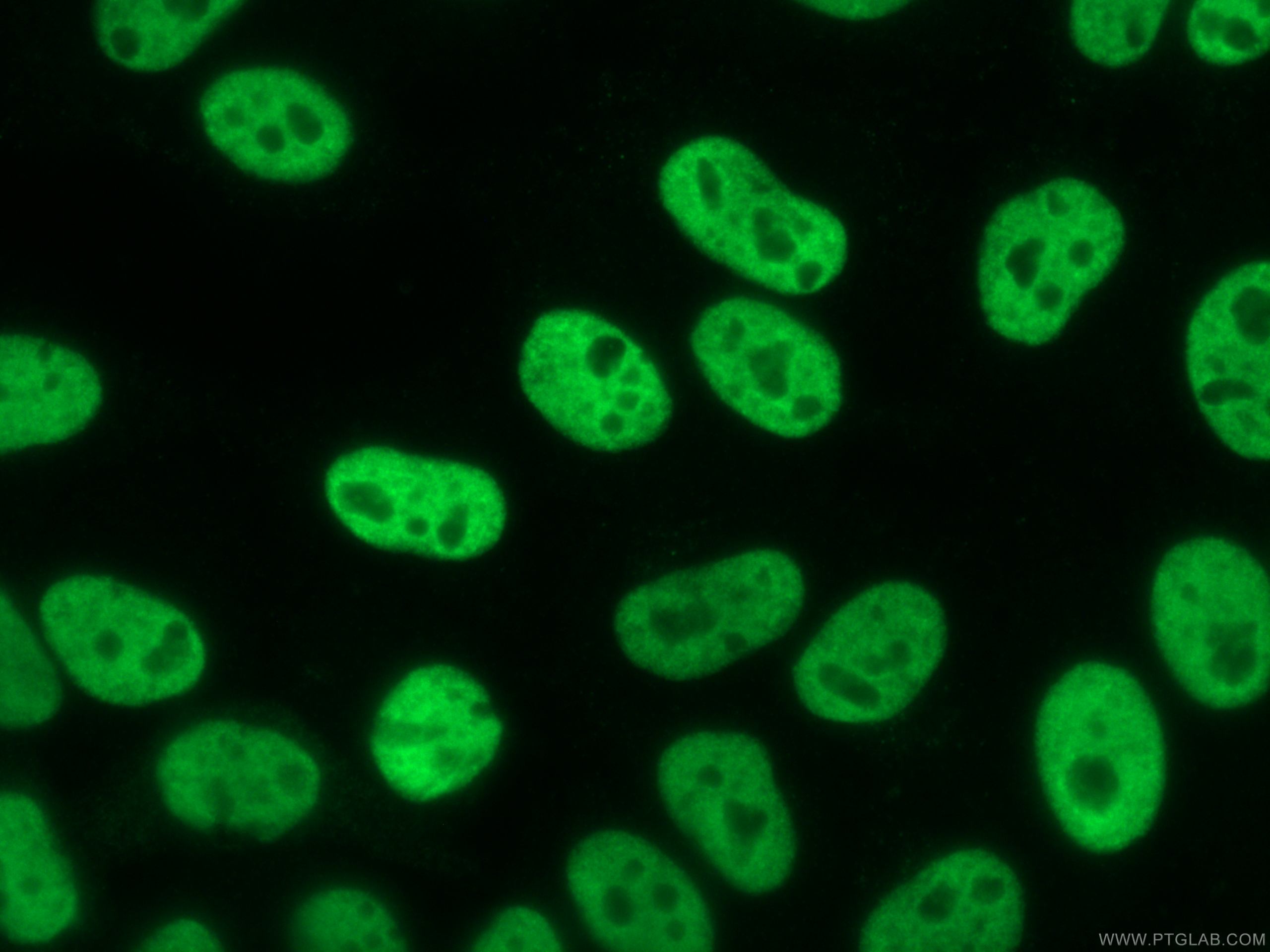 Immunofluorescence (IF) / fluorescent staining of HepG2 cells using RALYL Monoclonal antibody (67534-1-Ig)