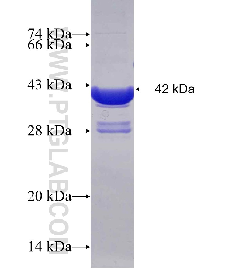 RALYL fusion protein Ag30310 SDS-PAGE