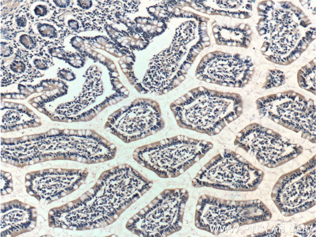 Immunohistochemistry (IHC) staining of human small intestine tissue using RAMP1 Polyclonal antibody (10327-1-AP)