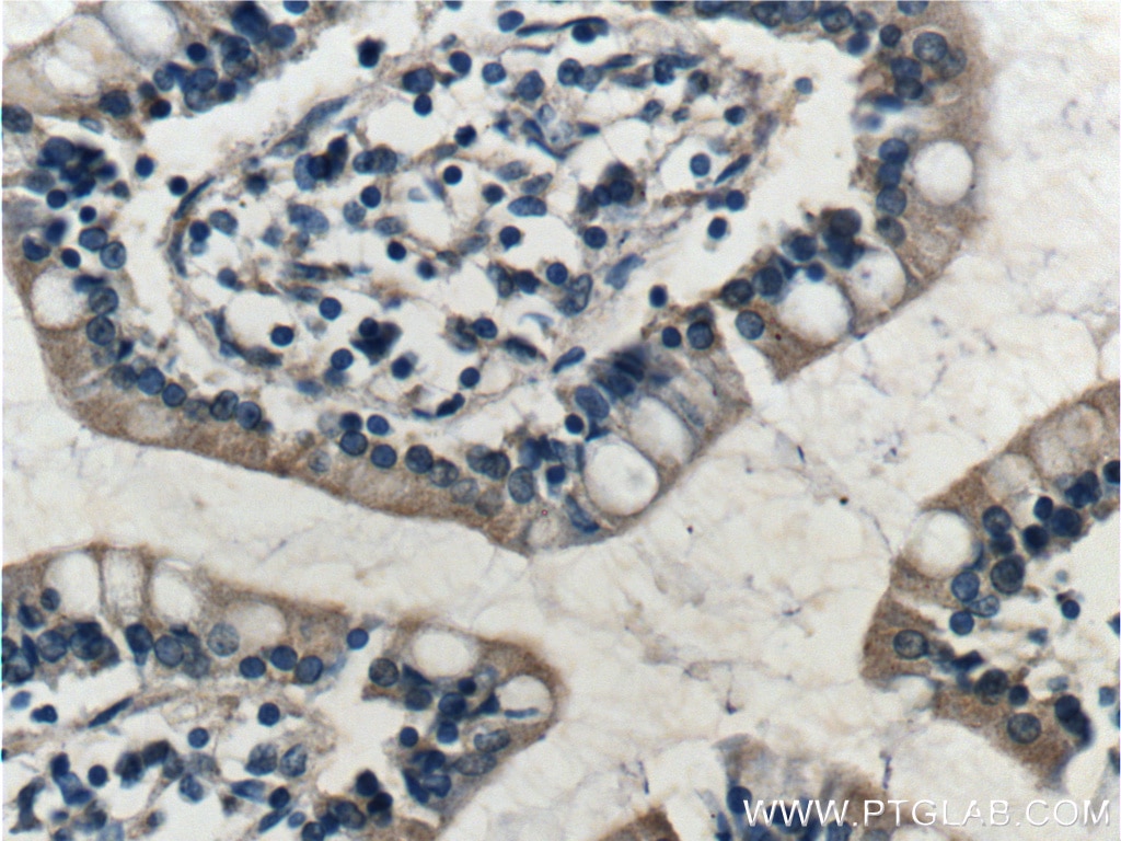 Immunohistochemistry (IHC) staining of human small intestine tissue using RAMP1 Polyclonal antibody (10327-1-AP)