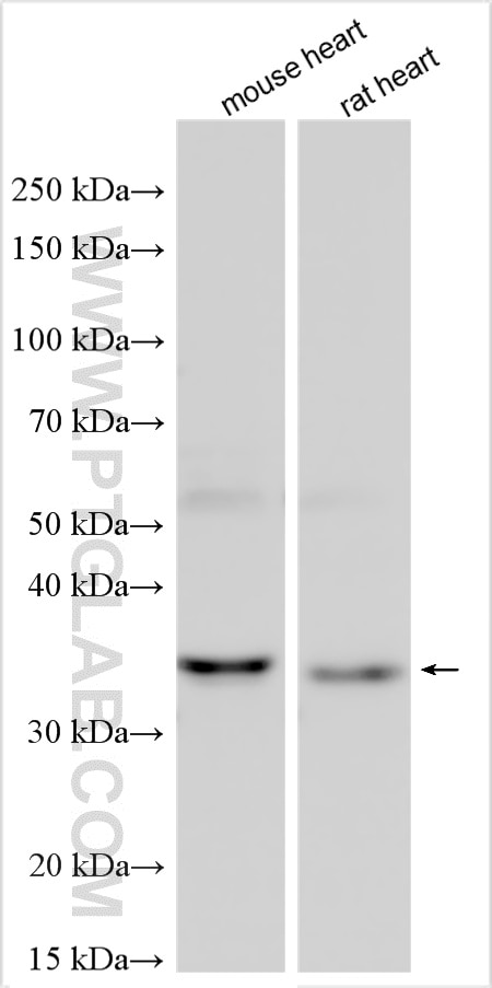 Western Blot (WB) analysis of various lysates using RAMP1 Polyclonal antibody (10327-1-AP)