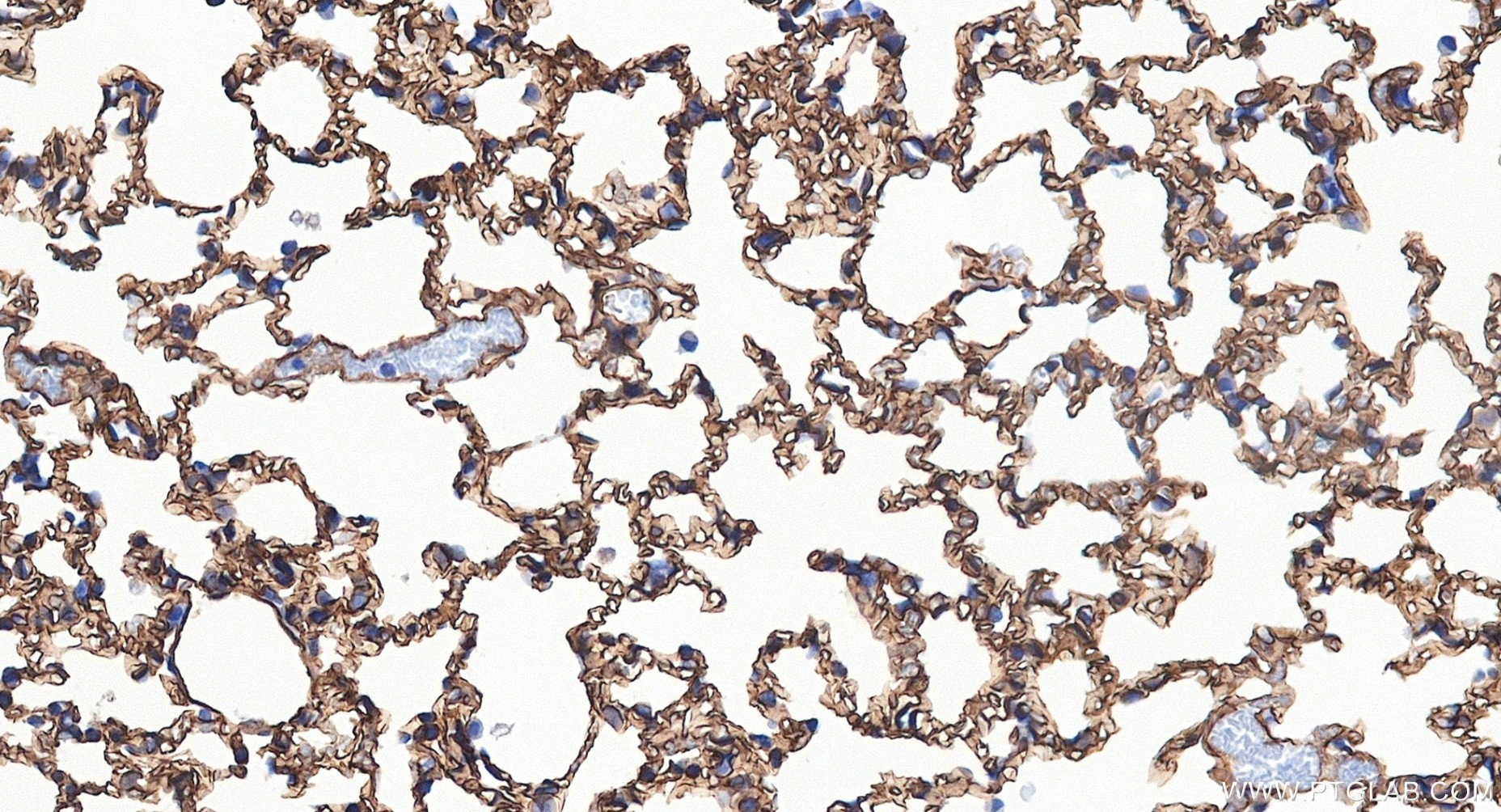 IHC staining of mouse lung using 88020-3-RR (same clone as 88020-3-PBS) Immunohistochemistry (IHC) staining of mouse lung tissue using RAMP2 Recombinant monoclonal antibody (88020-3-RR)