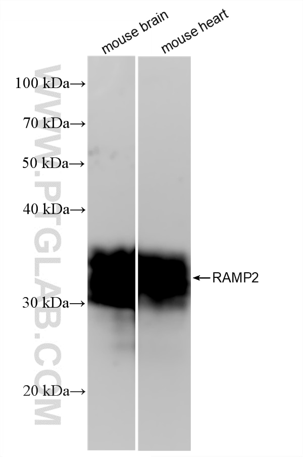 WB analysis using 88020-3-RR (same clone as 88020-3-PBS) Western Blot (WB) analysis of various lysates using RAMP2 Recombinant monoclonal antibody (88020-3-RR)