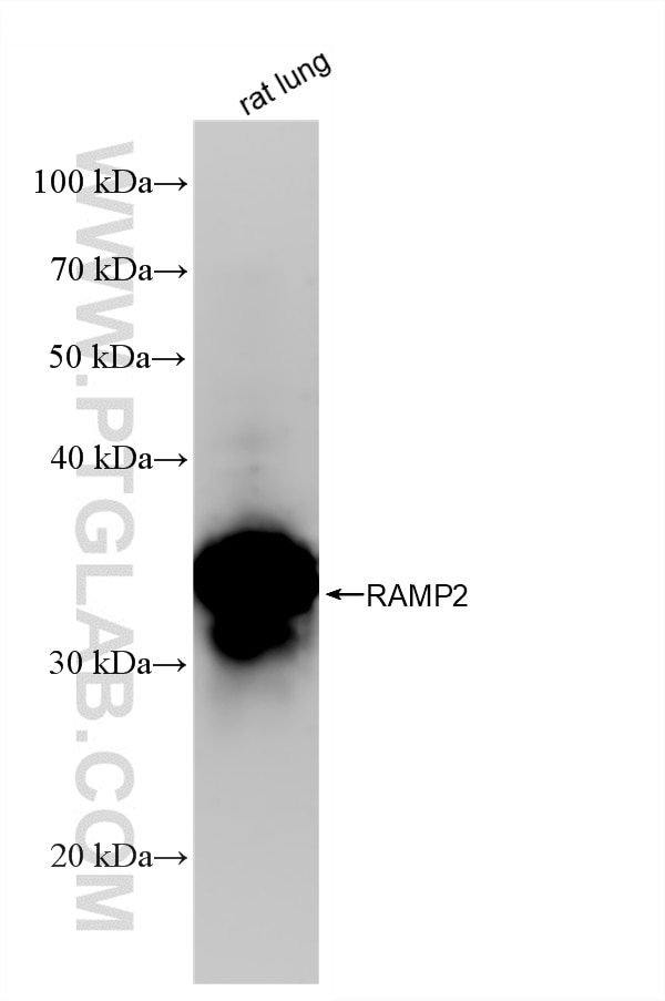 WB analysis of rat lung using 88020-3-RR (same clone as 88020-3-PBS) Western Blot (WB) analysis of rat lung tissue using RAMP2 Recombinant monoclonal antibody (88020-3-RR)