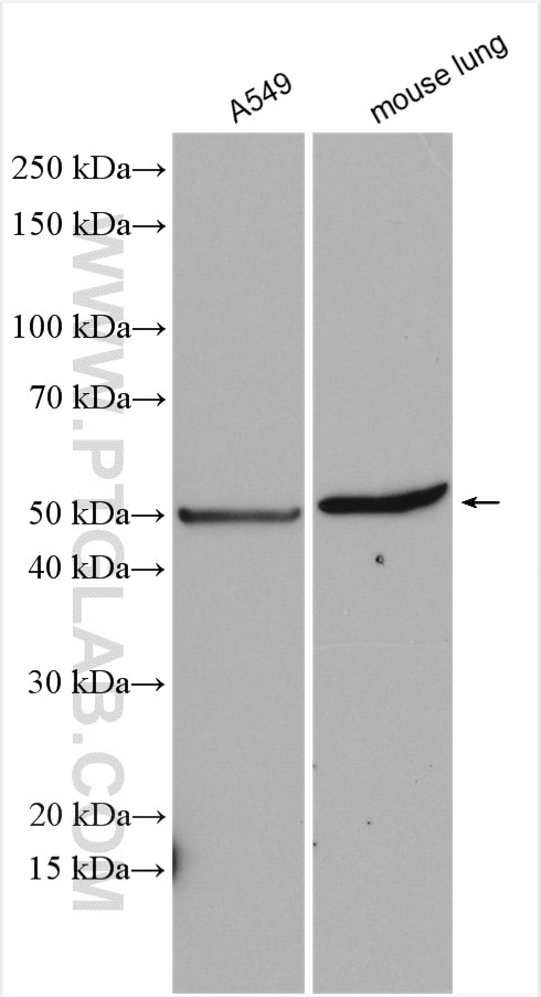 Western Blot (WB) analysis of various lysates using RAMP3 Polyclonal antibody (11861-1-AP)