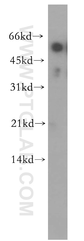 Western Blot (WB) analysis of human kidney tissue using RAMP3 Polyclonal antibody (11861-1-AP)