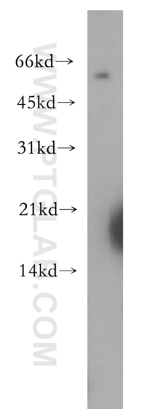Western Blot (WB) analysis of Jurkat cells using RAMP3 Polyclonal antibody (11861-1-AP)