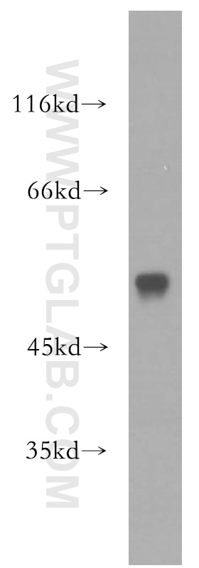 Western Blot (WB) analysis of mouse brain tissue using RAMP3 Polyclonal antibody (11861-1-AP)