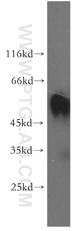 Western Blot (WB) analysis of mouse skeletal muscle tissue using RAMP3 Polyclonal antibody (11861-1-AP)
