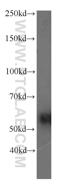 Western Blot (WB) analysis of mouse pancreas tissue using RAMP3 Polyclonal antibody (11861-1-AP)